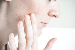 cum-se-foloseste-retinol