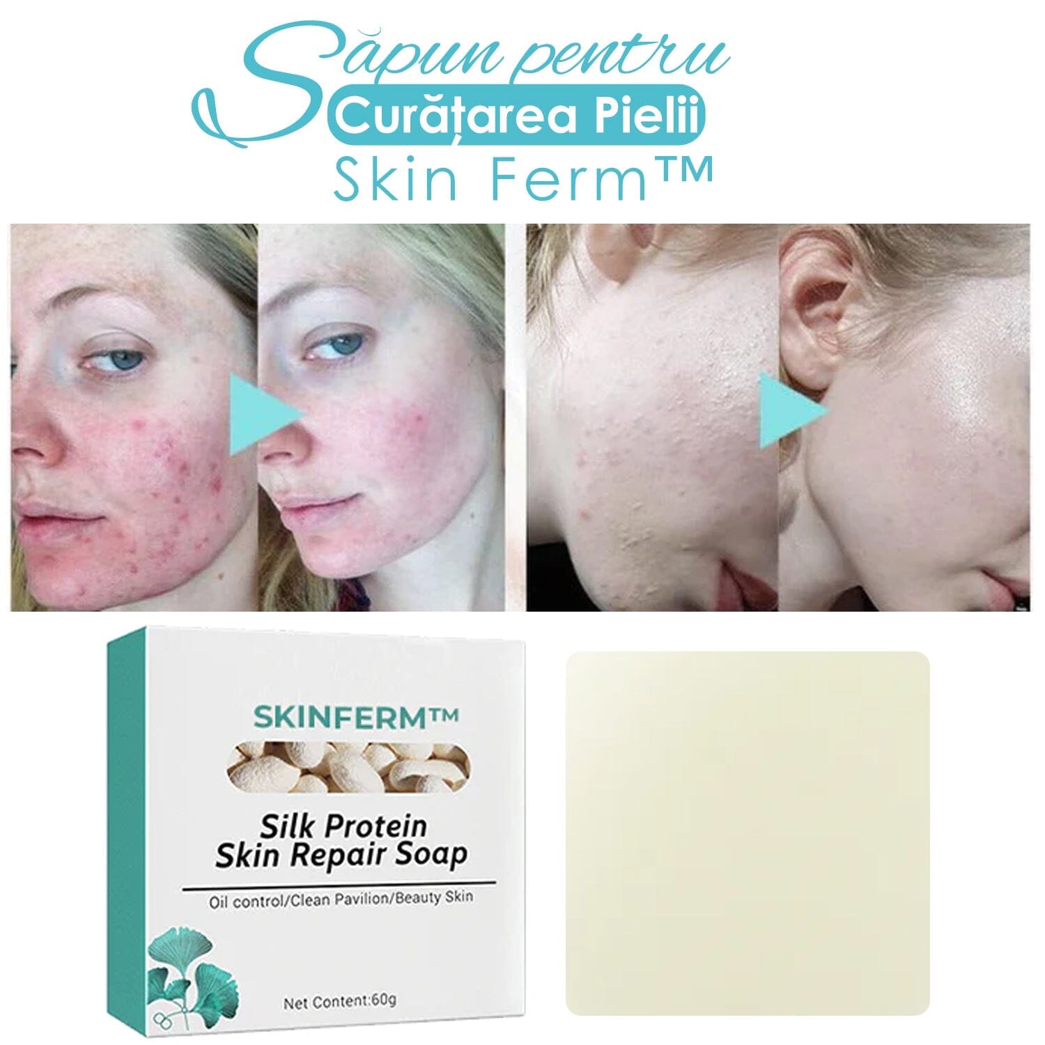 Sapun pentru Curatare Piele SkinFerm™ Sapun pentru Curatare Piele SkinFerm™